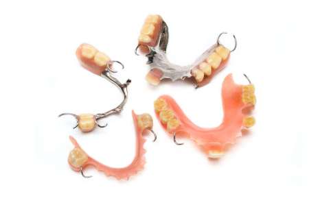 部分入れ歯の特徴
