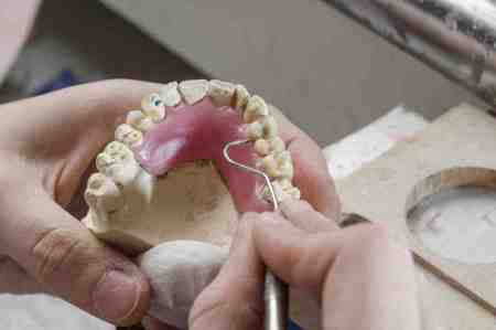 入れ歯の「歯ぐき」の素材とは？