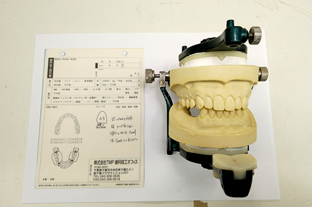 歯科技工指示書と咬合器