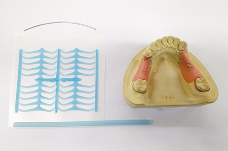 金具作成前の歯の模型